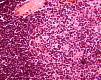 Parathyroid gland