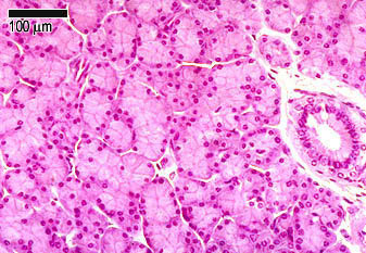 Parotid gland