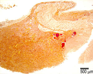 Pituitary