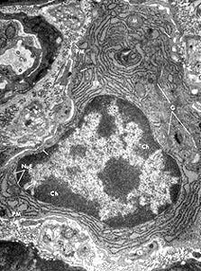 Plasma cell