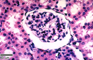 Renal corpuscle