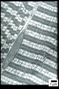 EM of muscle sarcomeres