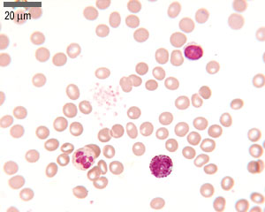Mystery cells