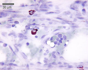 Loose connective tissue