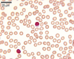 Mystery cells