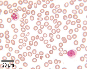 Mystery cells