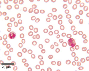 Mystery cells