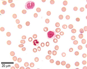 Mystery cells