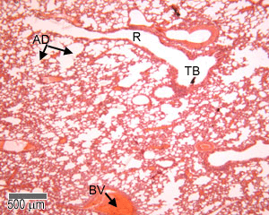 Terminal bronchioles