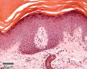 Epidermis of thick skin at lower power