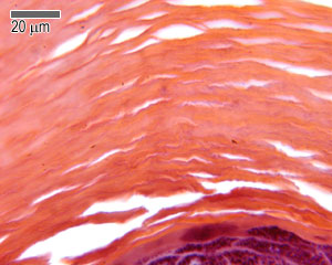 Stratum corneum