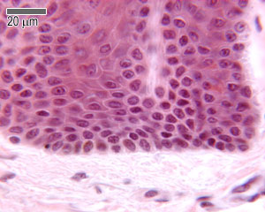 Stratum basale, and stratum spinosum