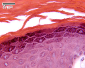 Stratum granulosum and stratum lucidum