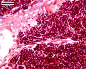 Lymphocytes