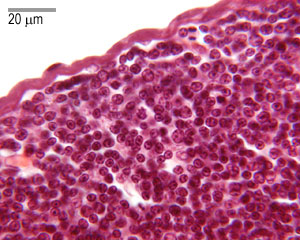 Part of the thymus