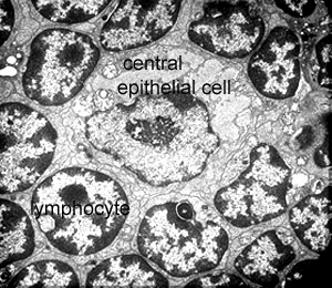 EM of lymphocytes in thymus