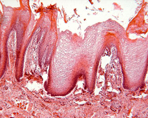 Vertical section of tongue