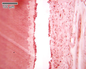Magnified section through a tooth
