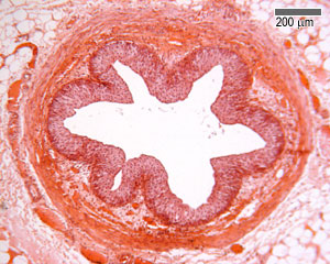 Ureter