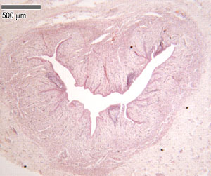 Urethra