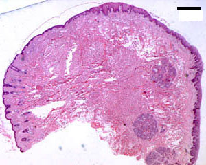 Section through the whole lip