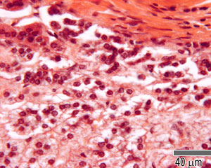 Zona glomerulosa