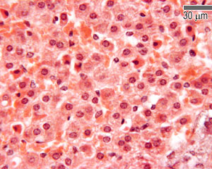 Zona reticularis