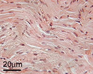Cardiac muscle