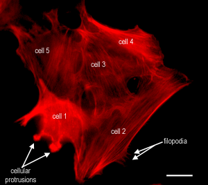 Actin in cell