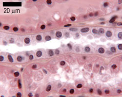Duct from the kidney