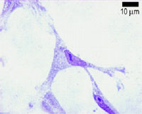Nucleus of a cell in interphase