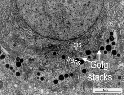 EM of golgi