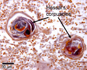 Hassal's corpuscles