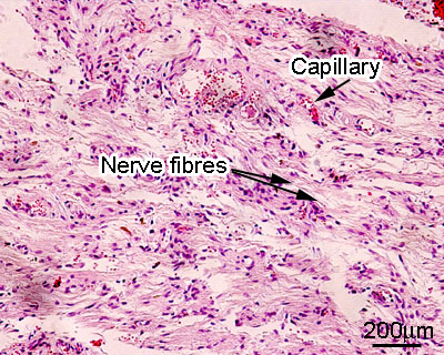 Posterior pituitary