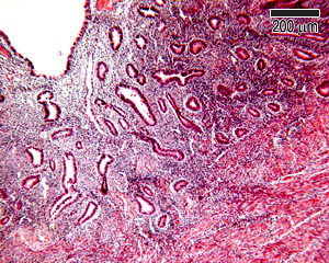Proliferative phase uterus