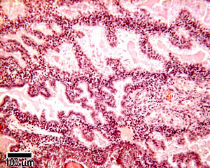 Secretory phase uterus