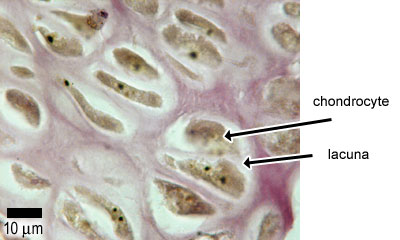 Hyaline cartilage