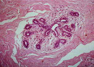 Secretory lobe