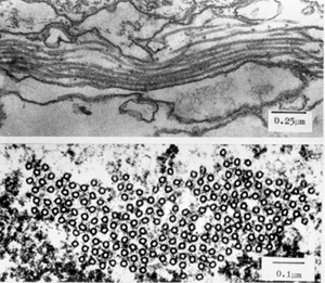 An EM of microtubules
