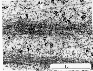 EM of microfilaments