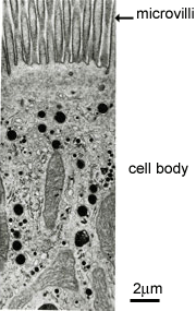 EM of microvilli