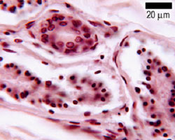 Duct and myoepithelial cells