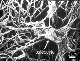Osteocyte (SEM)