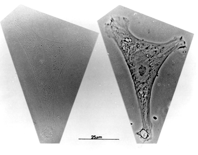 Cell in brightfield and phase optics
