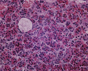 Anterior pituitary