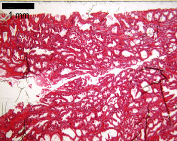 Prostate gland