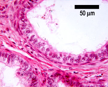 Seminal vesicle