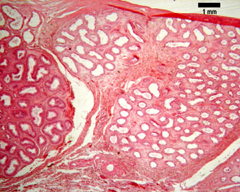 Seminal vesicles