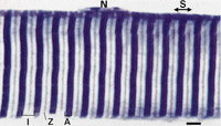 Muscle fibre showing striations