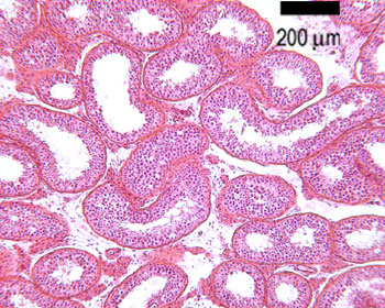 Seminiferous tubules